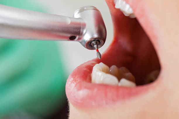 Best Broken or Cracked Tooth Emergency Dentist in Diamond Ridge, AK